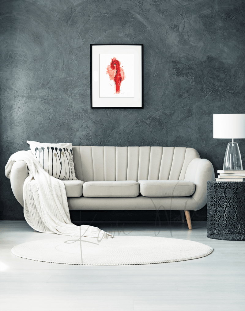 Thoracic Aneurysm Print Watercolor- Professional Art- Clinic decor- Office Decor- Gift for Doctor